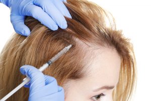 PRP for Female Hair Loss in Edina, MN | Medical Specialists